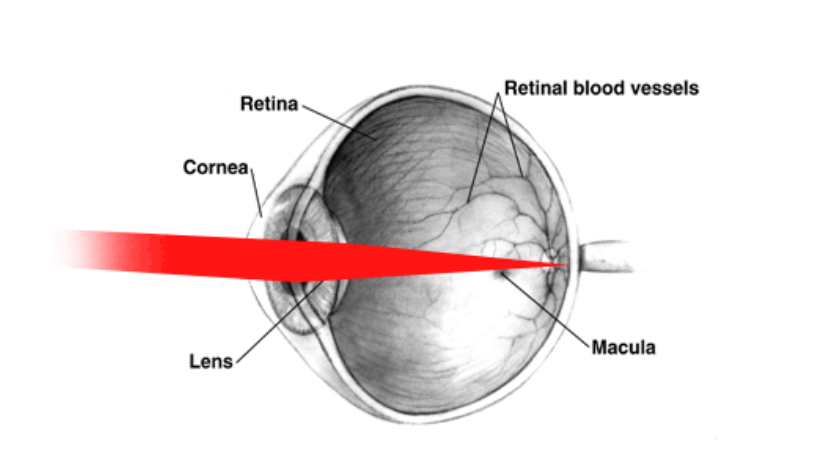 Laser into eyes.png